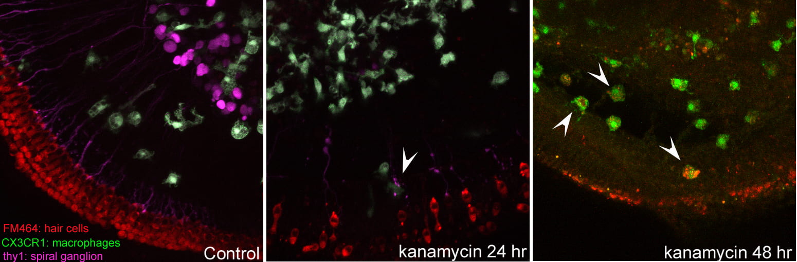 fluorescence microscopy of macrophages in inner ear