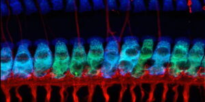 photo of fluorescent sensory hair cells and nerve fibers