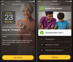 Remote checking is now available for cochlear implants