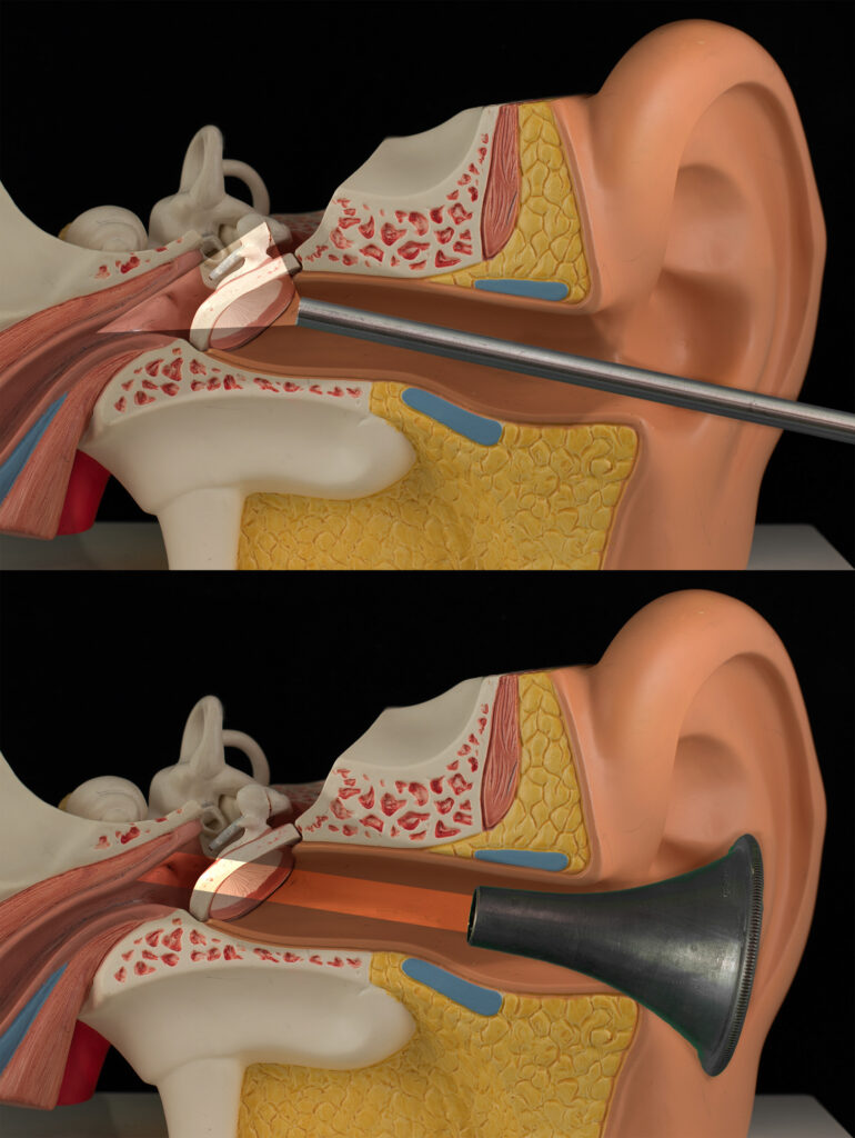 montage showing benefits of endoscopic surgery