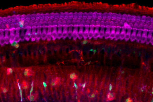 New animal model offers insights into CMV-induced hearing loss