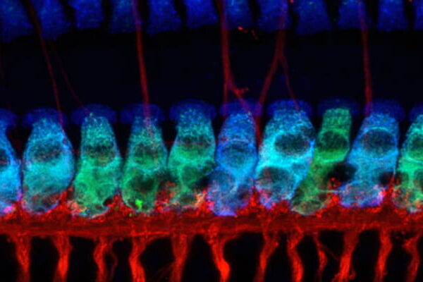 Noise-induced hearing loss blocked with drug compound