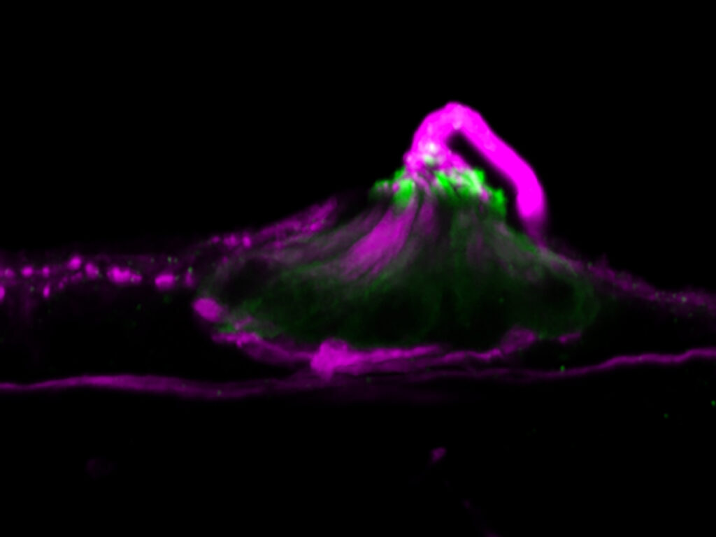 photo of zebrafish hair cells